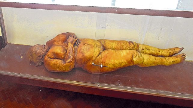 conservación. El cuerpo de la mujer puede verse en el Museo de Ciencias Morfólogicas de la cátedra de anatomía normal.