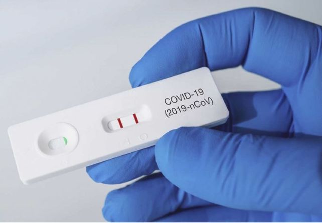 El Gobierno definió el modo en que se deberá informar el resultado de los autotest de Covid-19.