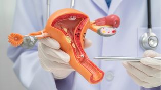 ¿Se puede prevenir el cáncer de cuello uterino?