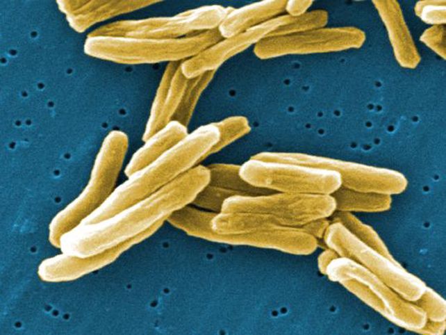 El origen de la tuberculosis