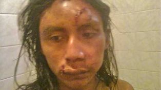 Formosa: brutal golpiza a dos jóvenes de la comunidad Qom, uno de ellos hijo del cacique