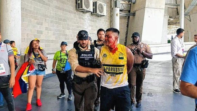 Varios hinchas fueron arrestados antes de la final de la Copa América Varios hinchas fueron arrestados antes de la final de la Copa América