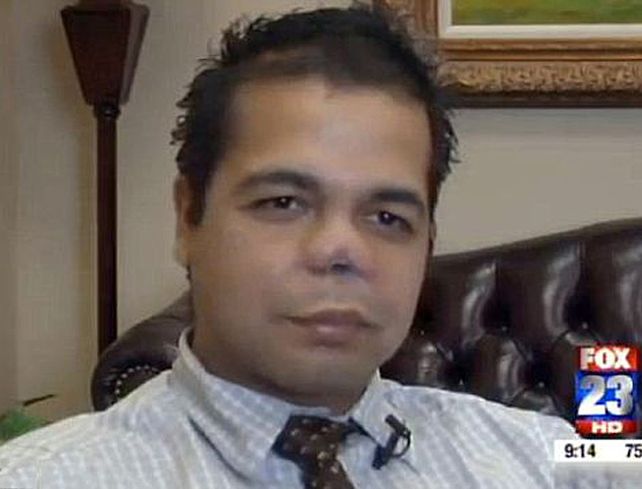Así quedó la nariz de Vishal Thakkar después de la enésima rinoplastia.