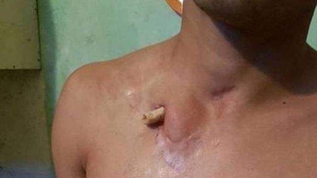 La impactante foto de un preso que indignó a un juez