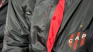 Rompió el silencio uno de los jugadores de Patronato atacado por la barra: Me dieron con la culata de un arma