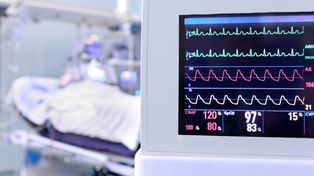 Problemas cardiovasculares causan el 28% de las muertes en Argentina
