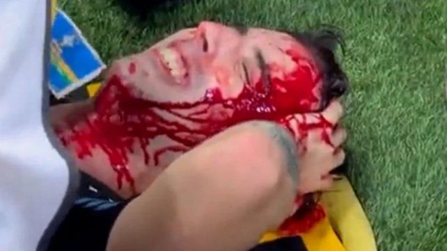 Un entrerriano fue herido durante la represión en el partido entre Argentina y Brasil.