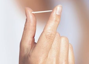 El implante subdérmico, el método anticonceptivo elegido por las jóvenes