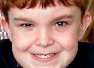 Implante pionero salva a niño de 11 años