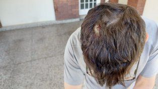Los culatazos en la cabeza lo dejaron herido