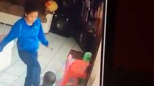 Estremecedor: el bebé que fue maltratado por su niñera tiene golpes en el rostro