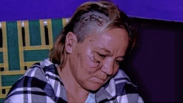 La mujer atacada junto a su nieta por los pitbulls en Santa Rosa de Lima: Si yo soltaba a la nena, se la devoraban