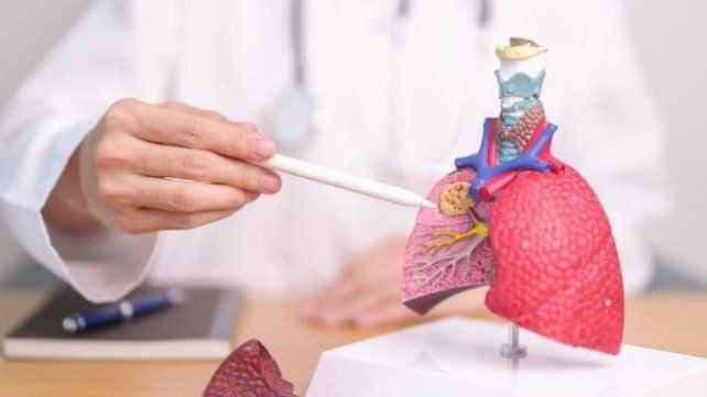 Paraná será sede de una Jornada Entrerriana de Fibrosis Quística.