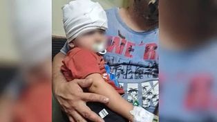 Un nene de un año y medio sufrió fractura de cráneo al caerle un pedazo de mampostería