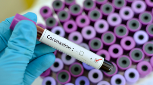 Son dos los casos positivos de coronavirus en la provincia