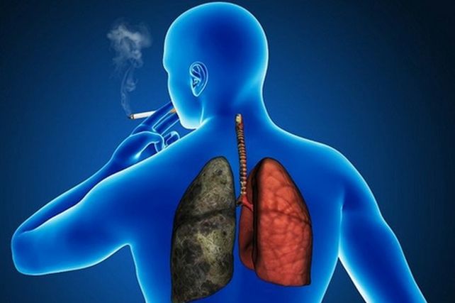 cáncer de pulmón&nbsp; Hacía más de 30 años que no había nuevas opciones terapéuticas en estados avanzados.