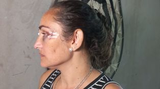 Emboscada en la puerta de su casa: atacaron a tiros a la hermana del intendente de una ciudad santafesina