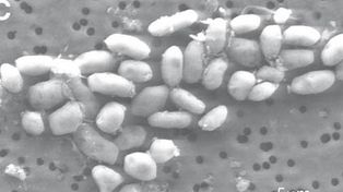 Descubrieron una bacteria que es capaz de sobrevivir en otro planeta