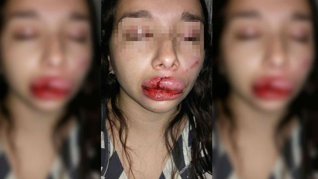 Intentaron violarla entre tres personas, no pudieron y la desfiguraron