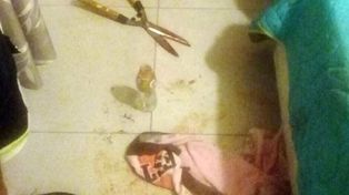 La mujer que fue detenida por cortarle los genitales a su ex reveló por qué lo hizo