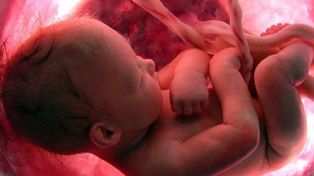 Los referentes de la medicina fetal se reúnen esta semana en Rosario