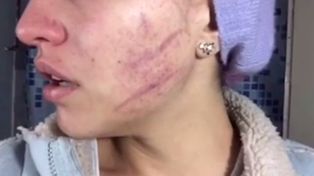 Golpeó brutalmente a una estudiante de teatro para que entrara en el personaje