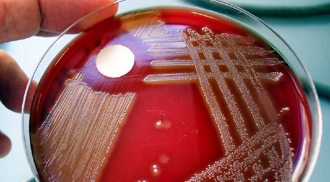 Salud advirtió que la bacteria estreptococo pyogenes es infrecuente