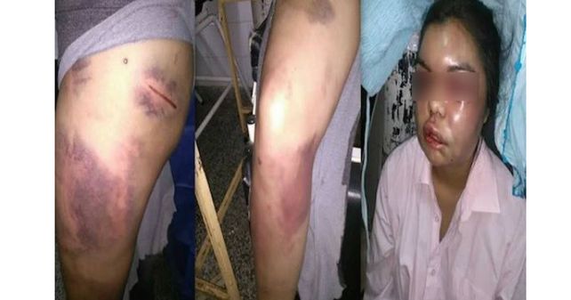 Le propinó reiteradas golpizas.