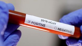 Son 17 los casos positivos de coronavirus en la provincia y hay 71 en estudio