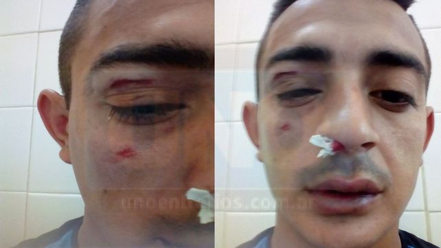Renzo Apduch fue agredido por el técnico de la categoría 2008 del Club Huracán de Diamante luego de la final de la Copa de Plata ante Diamantino.