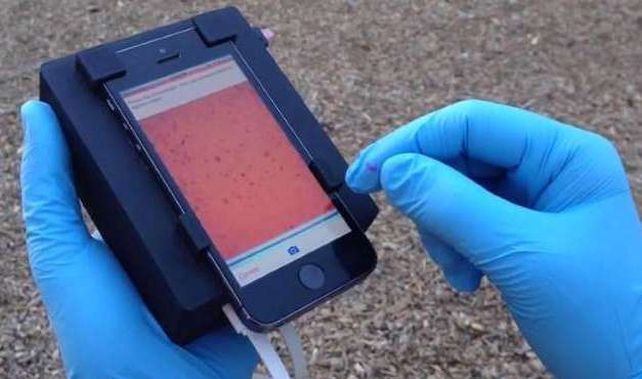 CellScope utiliza el movimiento en lugar de marcadores moleculares para detectar el desplazamiento de los parásitos.