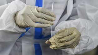 Japón le pidió a China el cese de pruebas de hisopado anal para Covid-19