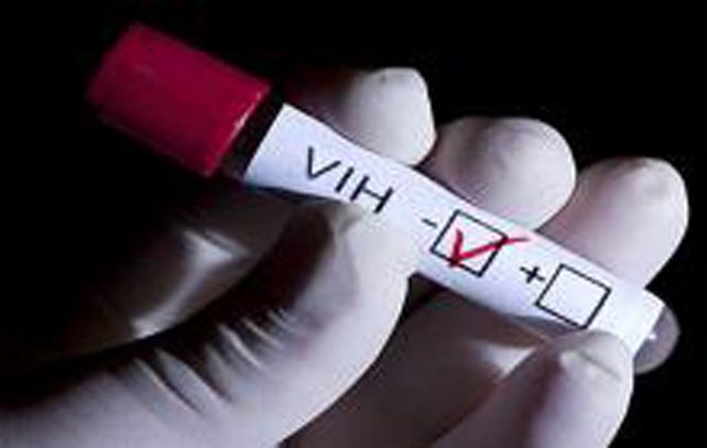 Descubren una molécula que destruye las células infectadas y podría ser el fin del HIV