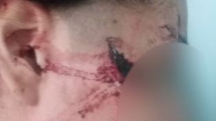 Brutal ataque en San Cristóbal: los agresores tuvieron la clara intención de matar a la adolescente de 15 años