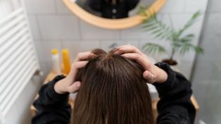 La caída del cabello es uno de los síntomas de falta de hierro. Pero hay personas que no tienen signos de alarma