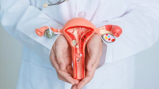 Endometriosis: una enfermedad frecuente que merece diagnóstico y tratamiento oportuno