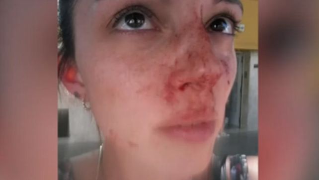 Una de las fotos que publicó la víctima en las redes sociales tras la agresión.