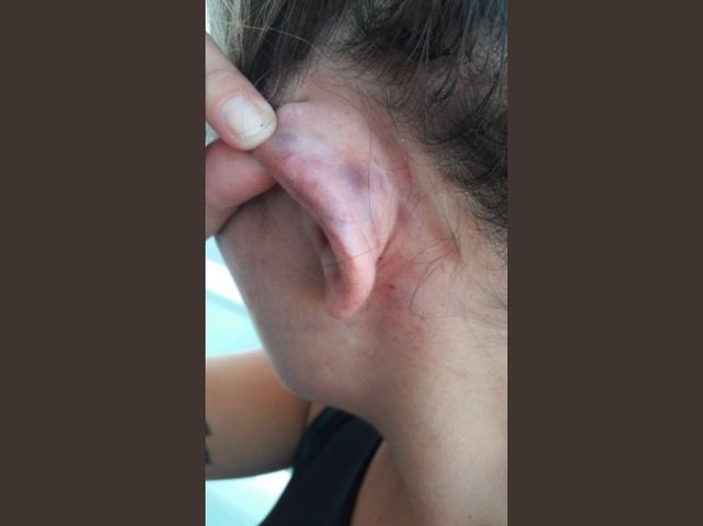 Una joven rosarina filmó el maltrato de su novio rugbier