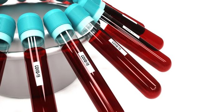 Reportan 1.870 contagios de coronavirus Covid-19 en Argentina