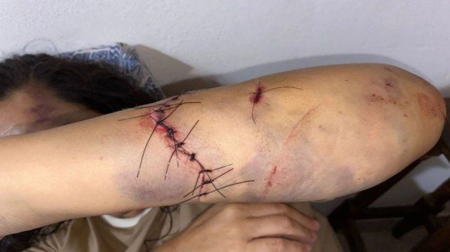 El violento hecho ocurrió en un campo de Santa Ana