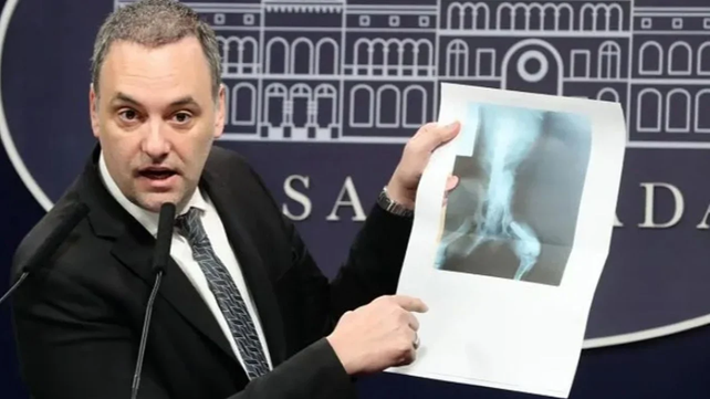 El vocero Manuel Adorni mostró la radiografía de un perro con la que se solicitó una pensión no contributiva por discapacidad.