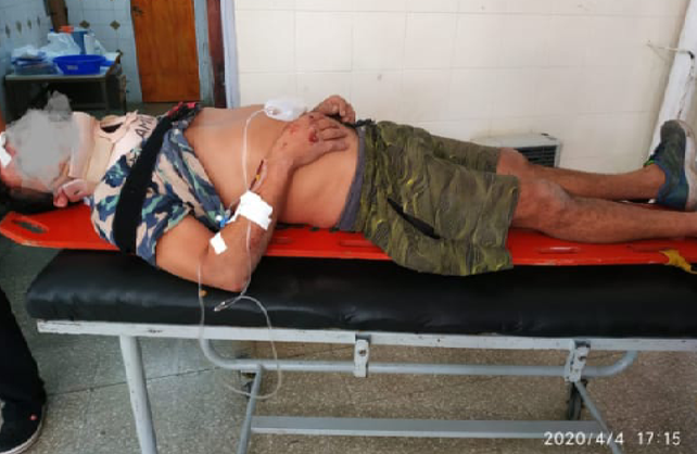 Ladrón frustrado: entró a robar, cayó del techo y quedó herido