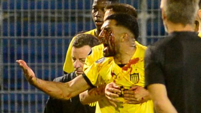 Maximiliano Olivera recibió un golpe con un proyectil en el pómulo y quiso buscar al agresor. Sus compañeros lo contuvieron.