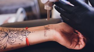 Mucho más que estética: cómo borrar tatuajes