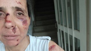 La mujer asaltada en la ciclovía