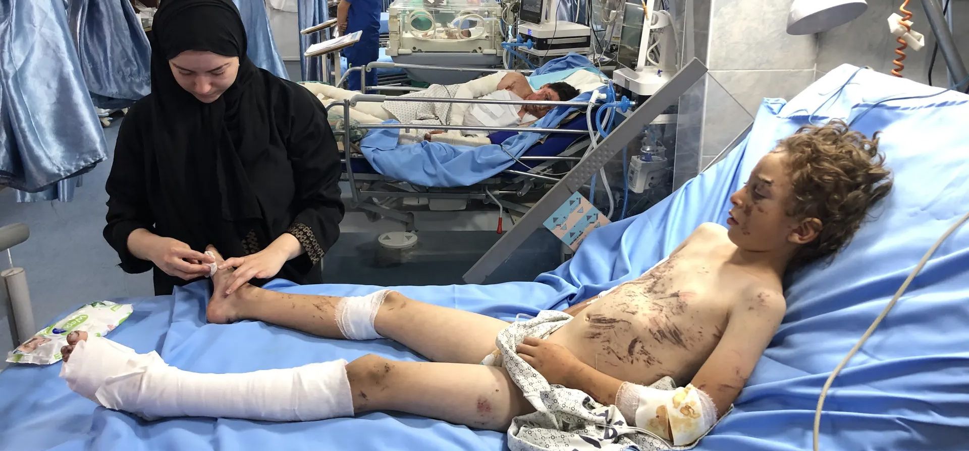 Los hermanos palestinos Abdulkerim Muhanna y Omar Muhanna, que se encontraban en la casa que fue blanco de un ataque aéreo israelí en el barrio de Sheikh Ridwan, reciben tratamiento en el hospital Kamal Adwan, el último hospital que funciona en el norte de la Franja de Gaza. Fotografía: Anadolu/Getty Images Los hermanos palestinos Abdulkerim Muhanna y Omar Muhanna, que se encontraban en la casa que fue blanco de un ataque aéreo israelí en el barrio de Sheikh Ridwan, reciben tratamiento en el hospital Kamal Adwan, el último hospital que funciona en el norte de la Franja de Gaza. Fotografía: Anadolu/Getty Images