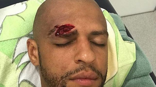 La imagen más impactante: 13 puntos en la cara tras un cabezazo