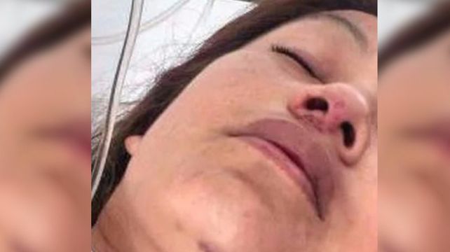 Una mujer se tiró de un segundo piso para evitar que su pareja la mate