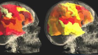 &iquest;Qu&eacute; sucede en el cerebro de las mujeres durante y despu&eacute;s de un orgasmo?