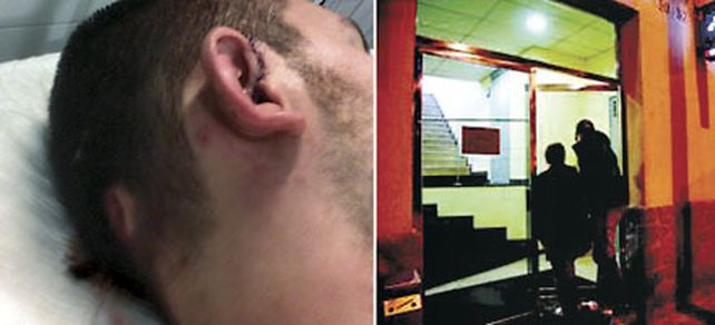 Los jugadores de Central Catalu&ntilde;a  fueron apaleados por barras neonazis